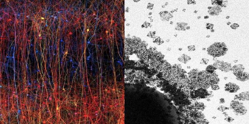 Il nostro cervello mostra un’architettura sempre più complessa